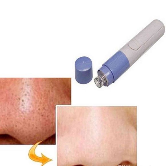 Pore cleansing system vacuum - Picture 2 of 3